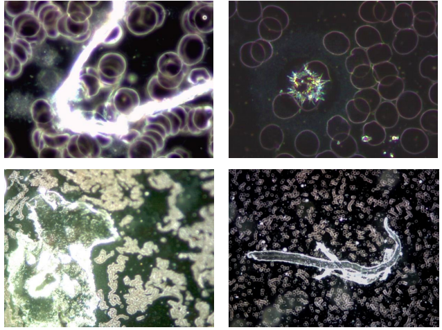 A LOOK INSIDE THE COVID VACCINES AND THE BLOOD OF THE VACCINATED