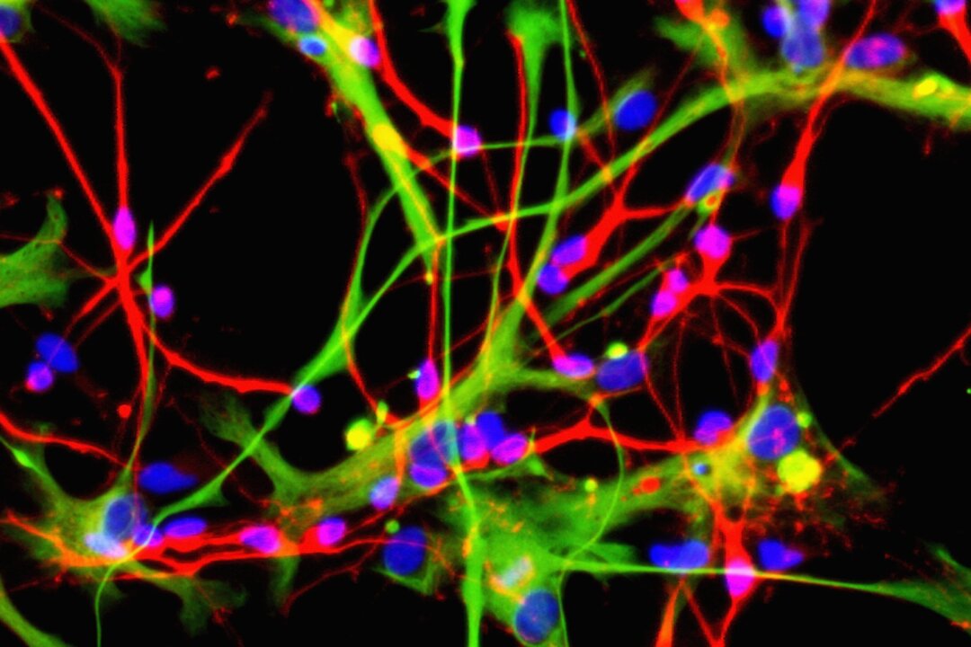 Neurons (red) and astrocytes (green), which can be made from neural stem cells, are seen in this undated file photo, released by the Institute for Stem Cell Research on Aug. 16, 2005. (Institute for Stem Cell Research via Getty Images)