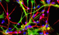 Researchers Develop Nanotechnology Technique to Restore Damaged Nerve Cells
