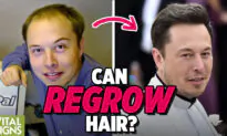 Losing Hair? Going Bald? Can it Really be Stopped?–Natural and Medical Methods