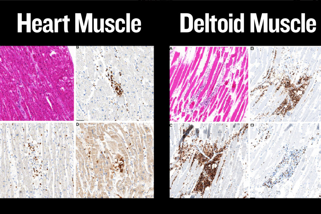 Found Dead at Home After COVID-19 Vaccination