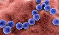 Strep A: 3 Doctors Explain What You Need to Look out For