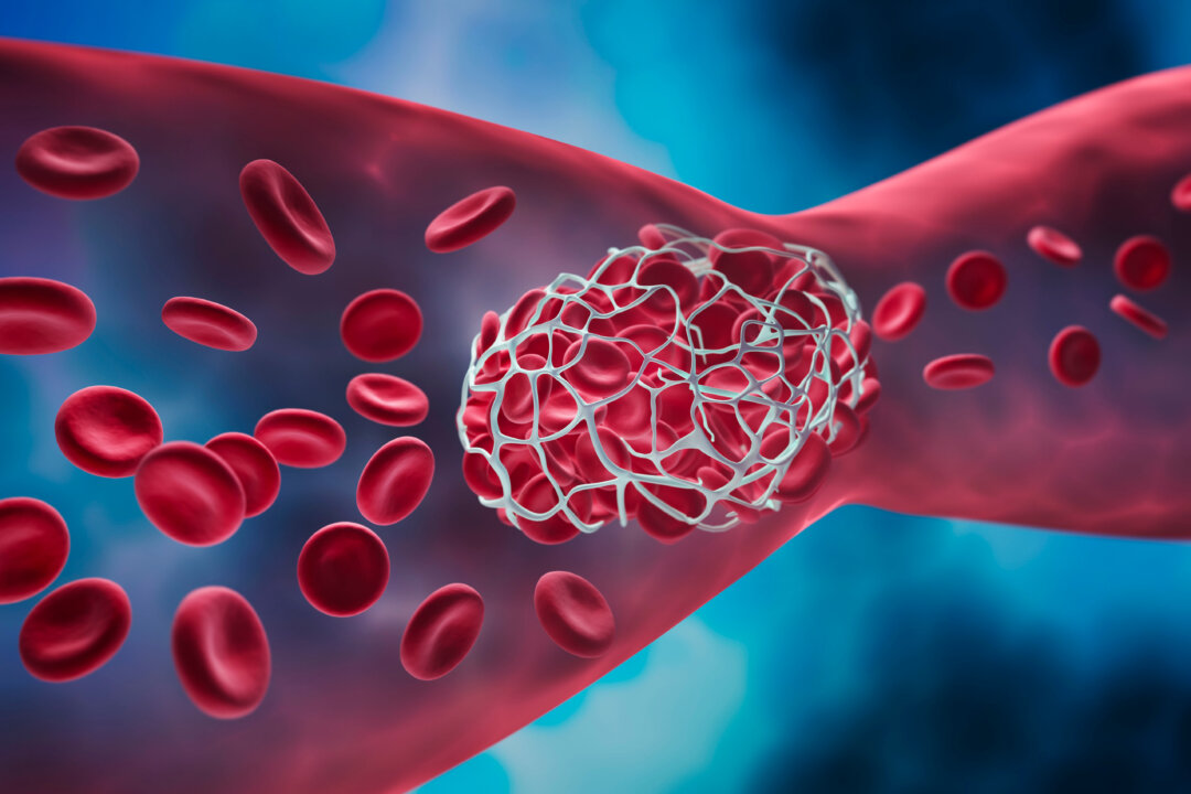As people age, their blood vessels become stiff, weak, and less flexible, which is easy to cause arteriosclerosis.(peterschreiber.media/Shutterstock)