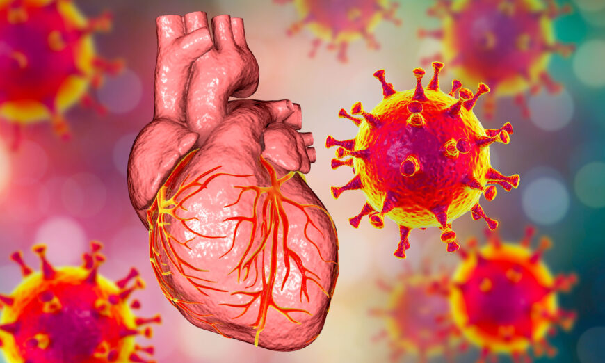 мРНК-вакцины вызывают миокардит, побуждая собственные иммунные клетки атаковать сердце, что может привести к внезапной смерти от желудочковой тахикардии или фибрилляции.  (Катерина Кон/Shutterstock)
