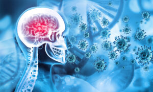 Growing Number of Neurological Complications After COVID-19 Vaccination