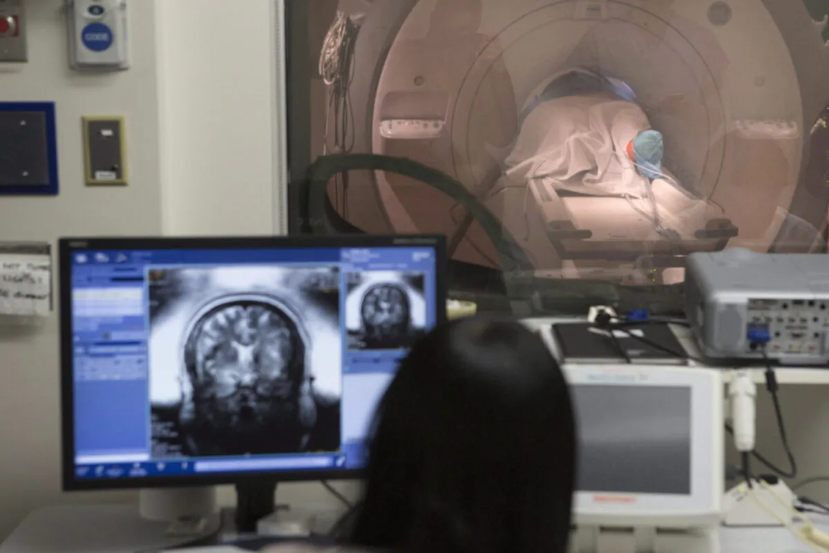 An image of a patient’s brain is displayed on a monitor screen as she lies in an MRI machine at Sunnybrook Hospital in Toronto on May 1, 2018. (Chris Young/The Canadian Press)
