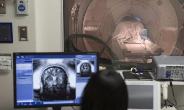 2018 年 5 月 1 日，在多伦多 Sunnybrook 医院的 MRI 机器上，一名患者的大脑图像显示在监视器屏幕上。（Chris Young/加拿大出版社）