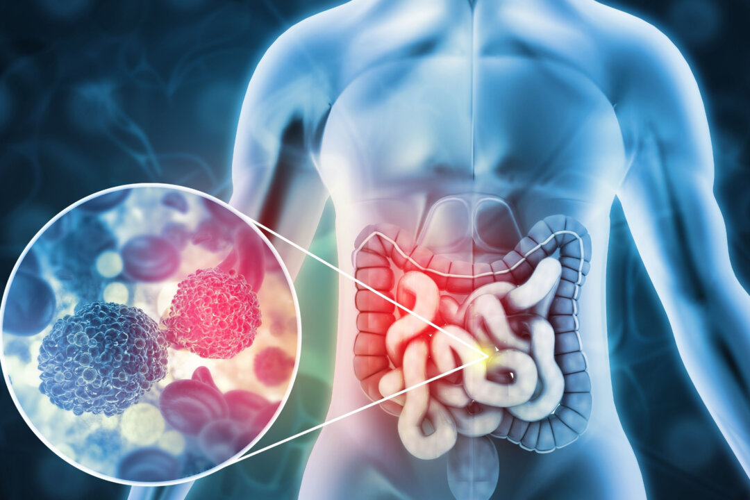 Gas is mostly produced from the intestines, and the smell and frequency of it can reflect the health of the digestive tract. (crystal light/Shutterstock)