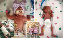 Healthy Twin Saves Her Sister’s Life by Sending Out Distress Signals Forcing Doctors to Deliver Them Early