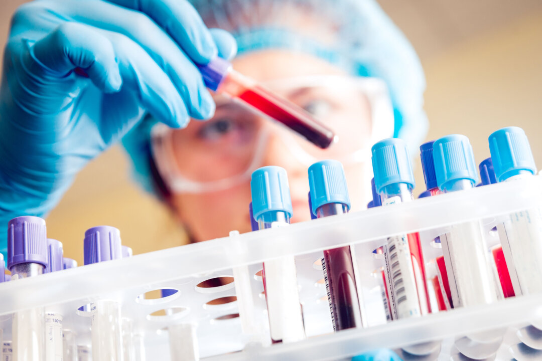 Using the GAGs test, patients with undetected cancer showed a 39 to 50 percent lower risk of death, and the test predicted cancer location with 89 percent accuracy. (Roman Zaiets/Shutterstock)