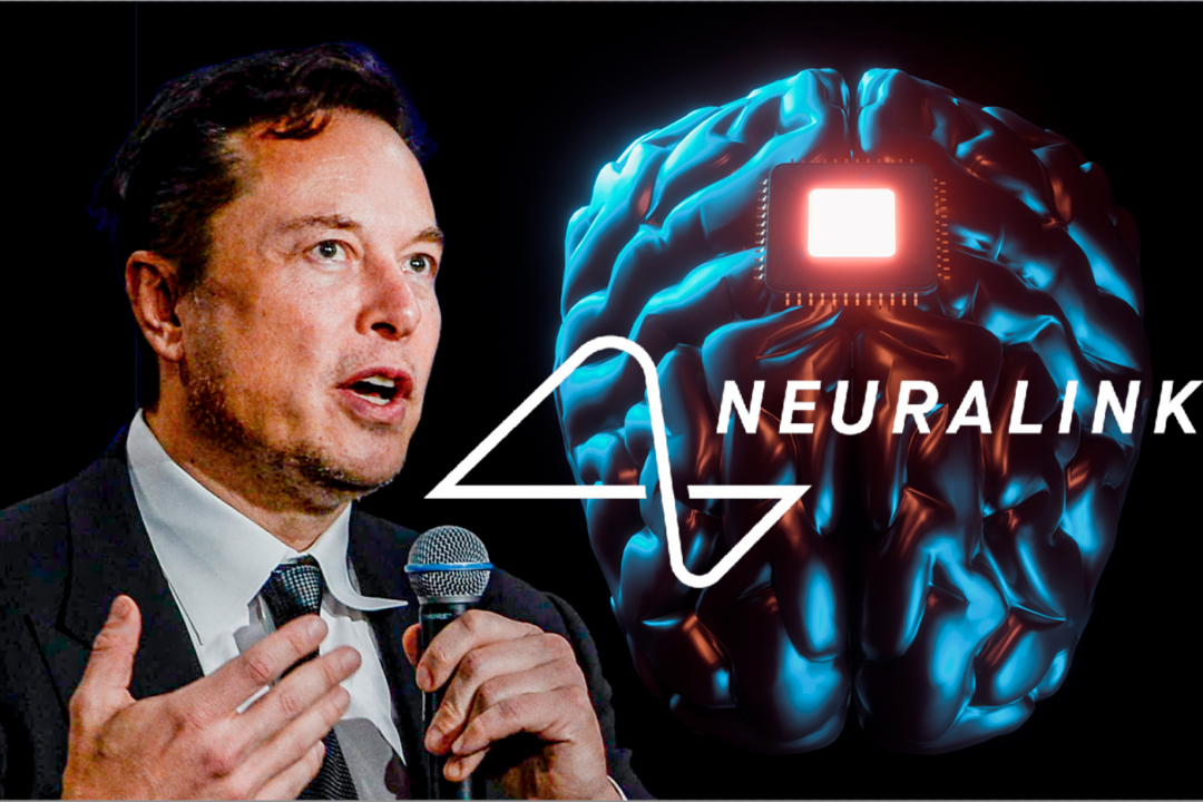 Elon Musk’s Neuralink Gets FDA Approval to Study Brain Implants in Humans