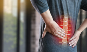 A Surprising Contributor to Chronic Low Back Pain