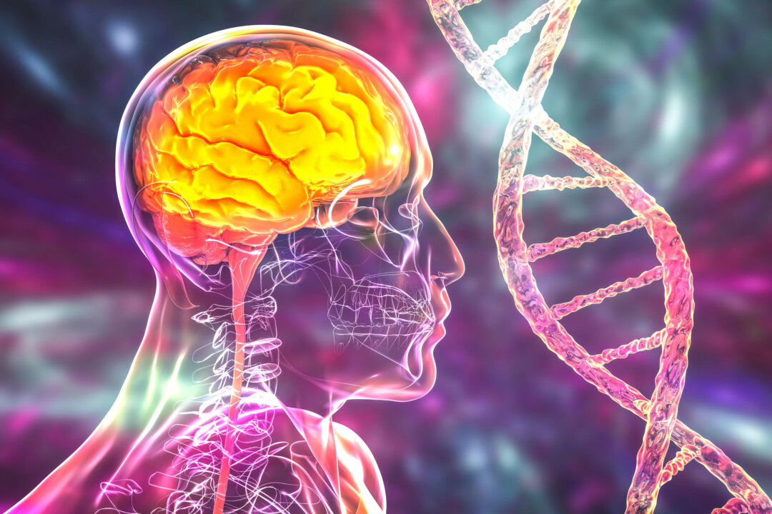 Although only about 20 percent of the human population carries ApoE4, it accounts for an estimated 40 to 65 percent of Alzheimer's disease (AD) cases. (Kateryna Kon/Shutterstock)