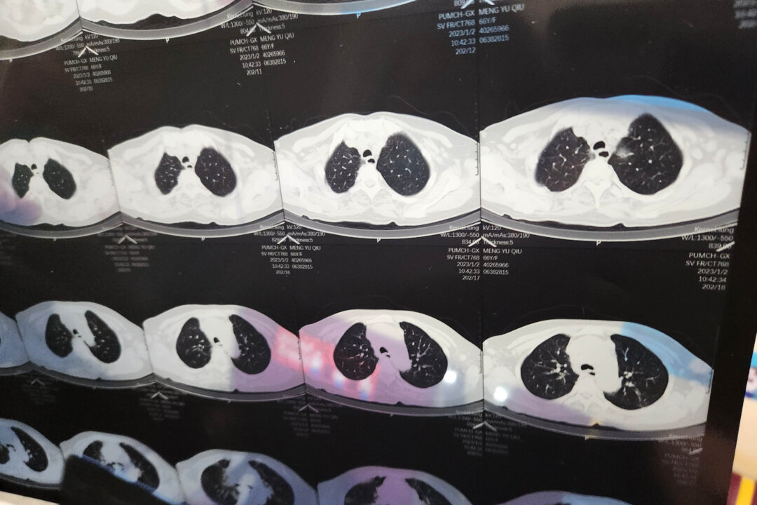 A doctor looks at a CT image of a patient in Haidian, Beijing, China, on Jan 2, 2023. (CFOTO/Future Publishing via Getty Images)
