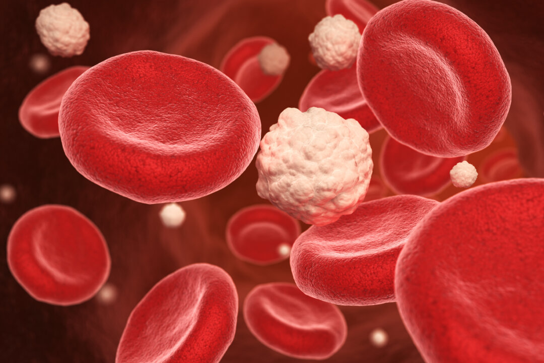 Pre-diabetic patients develop insulin resistance due to the decreased sensitivity of cells to insulin, so the body has to secrete a large amount of insulin to suppress blood sugar levels. (Shutterstock)