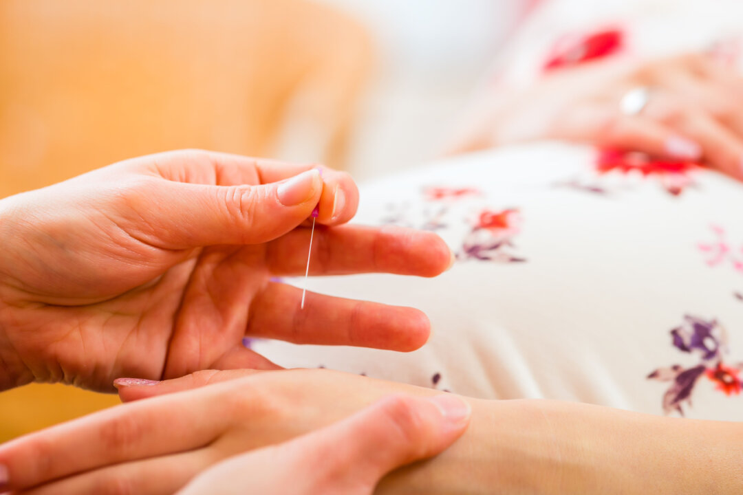 Midwife applying acupuncture on a pregnant woman. (Kzenon/Shutterstock)