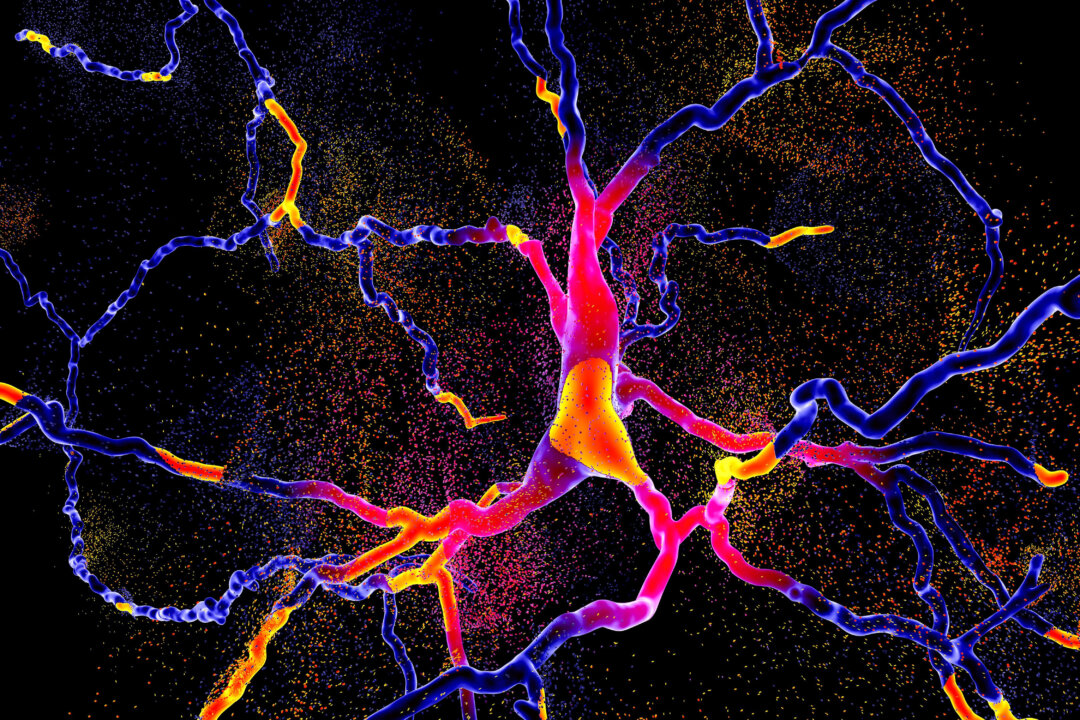 Parkinson’s is a disease that attacks the nerve cells that create a chemical called dopamine, resulting in low dopamine levels in the brain. Dopamine is responsible for muscle control and movement.(Shutterstock)