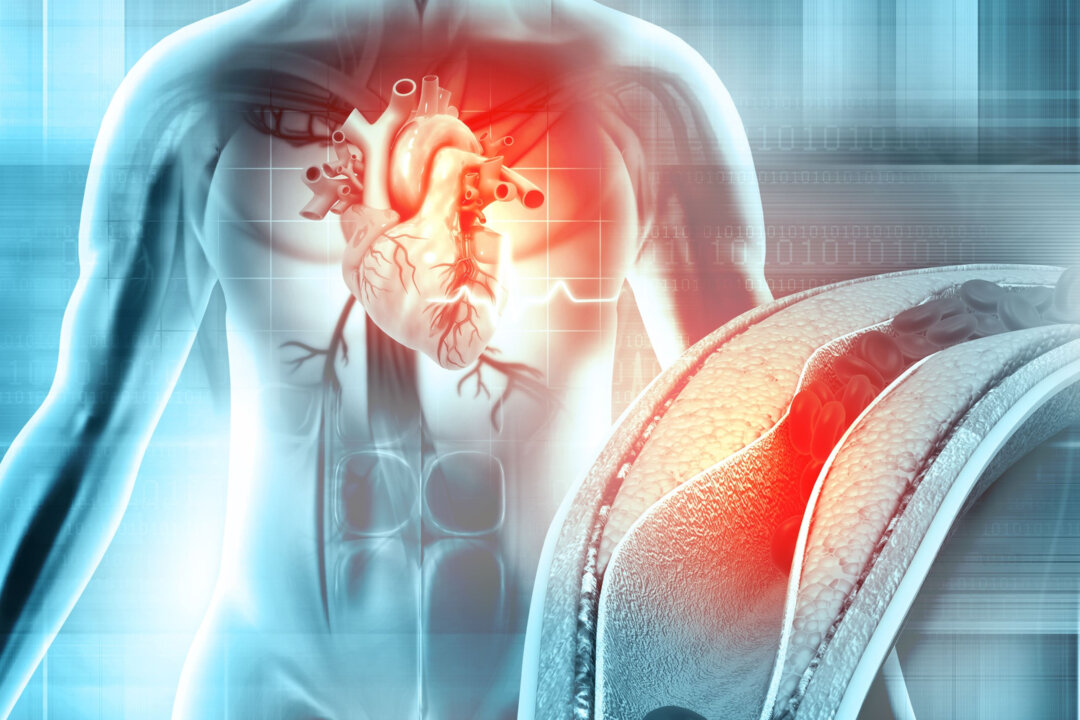 Why Heart Attacks Happen—Expert Shares Key Reason