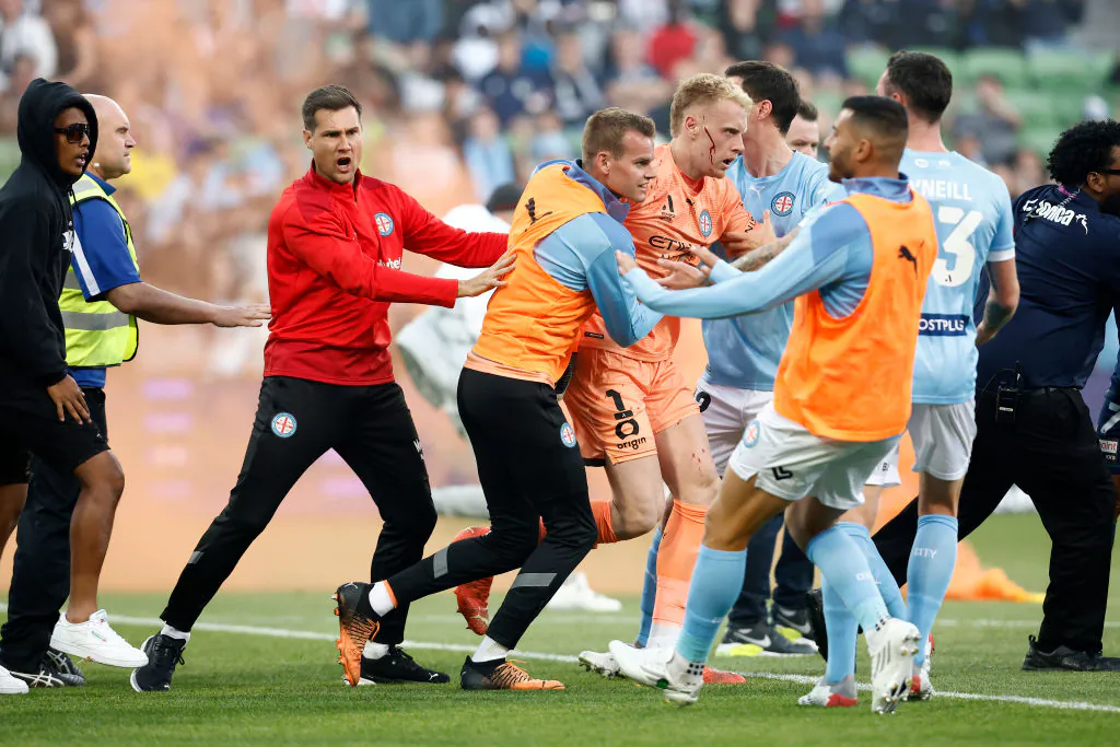  A bleeding Tom Glover of Melbourne City is escorted from the pitch by team mates after fans stormed the pitch during the round eight A-League Men's match between Melbourne City and Melbourne Victory at AAMI Park, on December 17, 2022, in Melbourne, Australia. (Photo by Darrian Traynor/Getty Images)