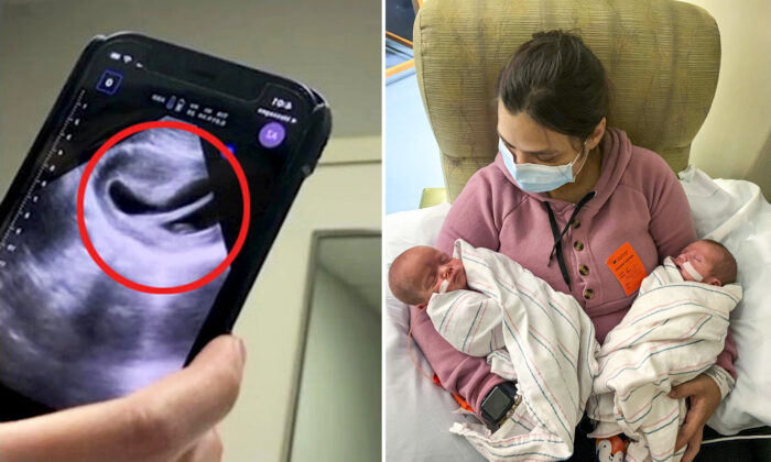 Mom With Heart-Shaped Uterus Defies the Odds to Give Birth to 1-in-500 Million Twins and They’re Now 16 Months Old