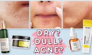 Stress Acne: 4 Ingredients for Calming Stressed Out, Acne-Prone, & Irritated Skin (ft. Biossance)