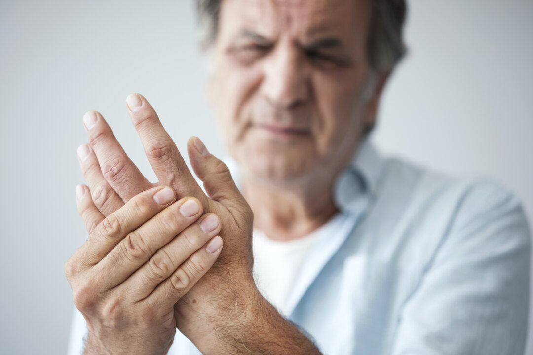A repurposed drug may help hand osteoarthritis. (Shutterstock)