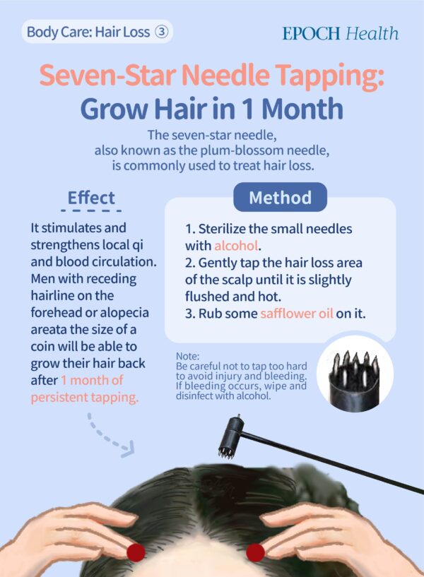 Tapping with seven-star needle to treat hair loss