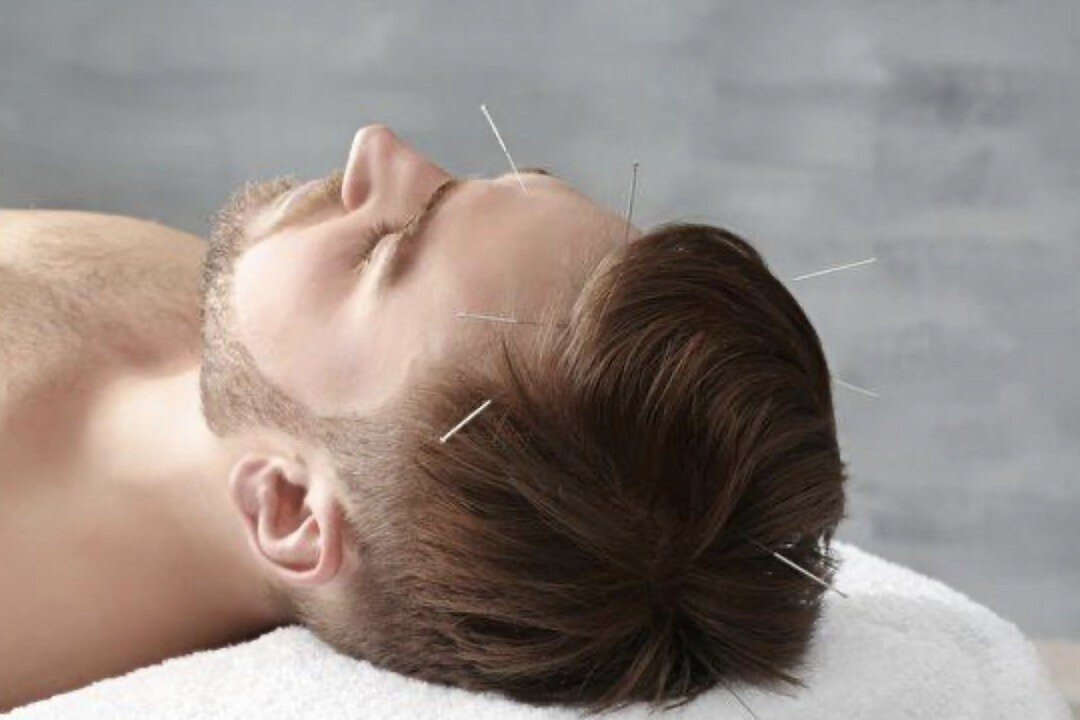 Acupuncture to Relieve Neck Pain, Plus 9 Tips to Prevent Cervical Spondylosis