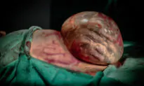 Photographer Captures Incredible Pictures of a Baby Born via Cesarean Section While Still Inside His Amniotic Sac