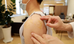 Clinical Research: Korean Medicine Treatment Is Effective in Treating Shoulder Osteoarthritis