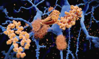 2 Fast-Approved Anti-Amyloid Alzheimer’s Drugs Raise Concerns
