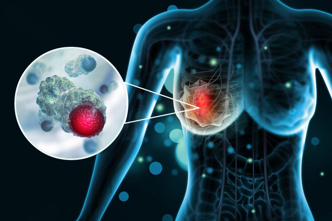 Mammograms are the go-to test to find potential breast cancer but other testing tools offer benefits and may lower risks. 
(crystal light/Shutterstock)