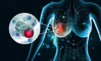 Finding Breast Cancer—Low Risk Early Detection Tools You May Not Know About