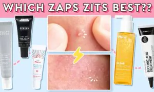 How to Take Care of Your Breakouts, Blackheads, & Whiteheads! (ft. Hero Cosmetics)