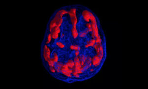 Using Brain Scans and Lifestyle to Resolve Mental Illness