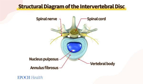 Intervertebral discs cushion the shock generated during movement