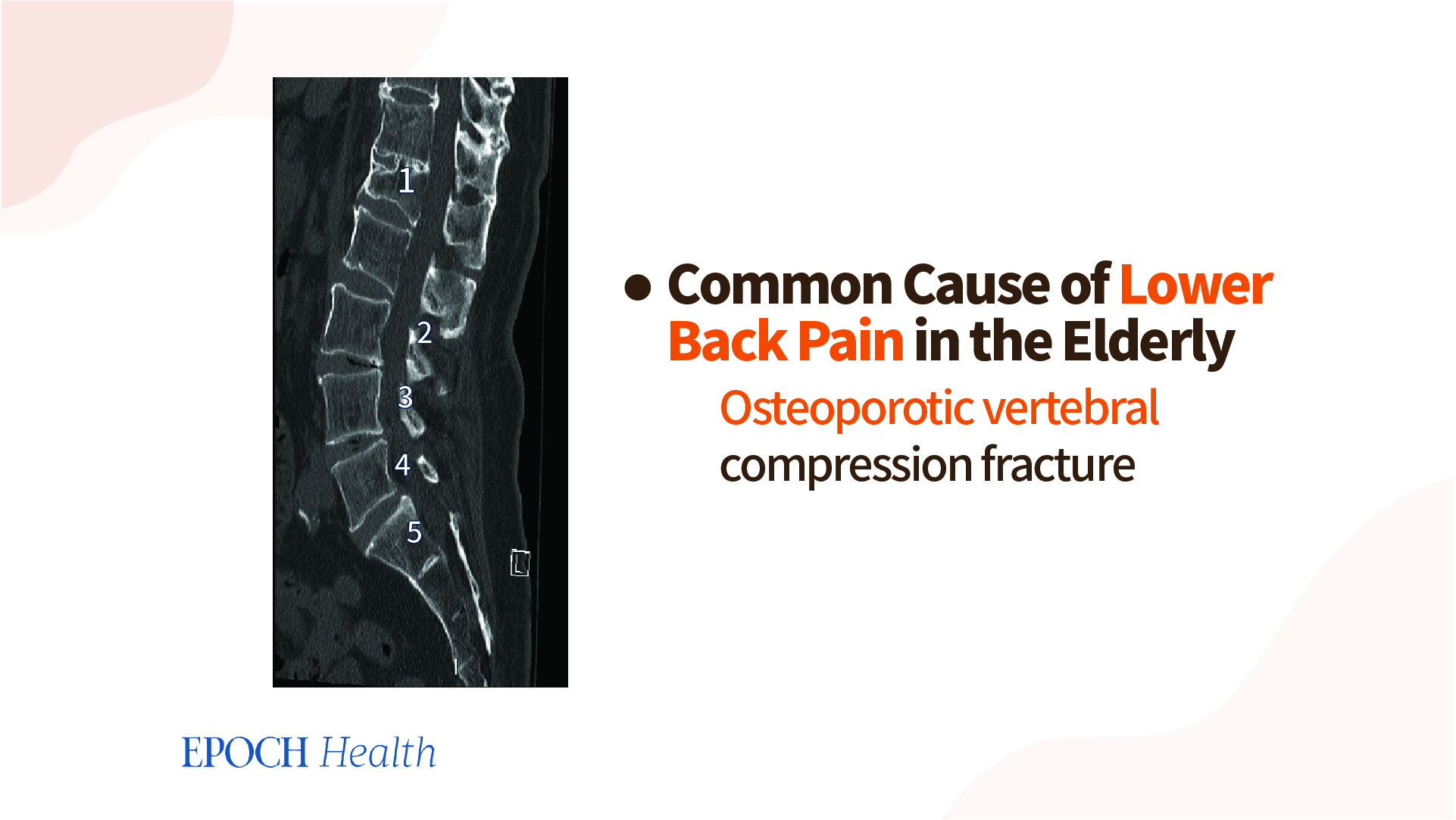 https://img.theepochtimes.com/assets/uploads/2023/01/25/back-pain-4.jpg