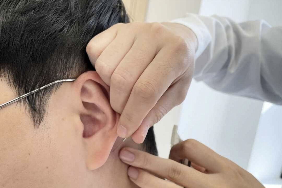 In China, South Korea, and other Asian countries, acupuncture has been used to treat stroke for thousands of years. (Courtesy Jaseng Center for the Alternative Medicine, South Korea)