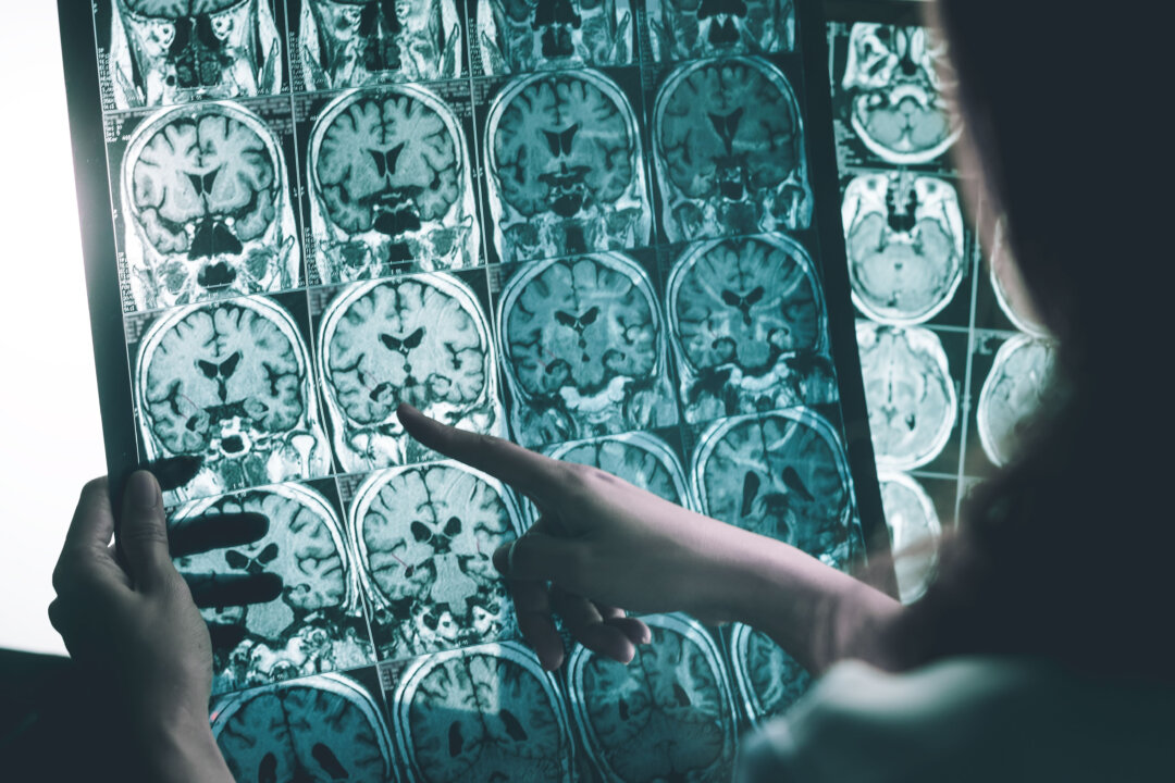 1 Modifiable Condition to Slow Alzheimer’s Disease