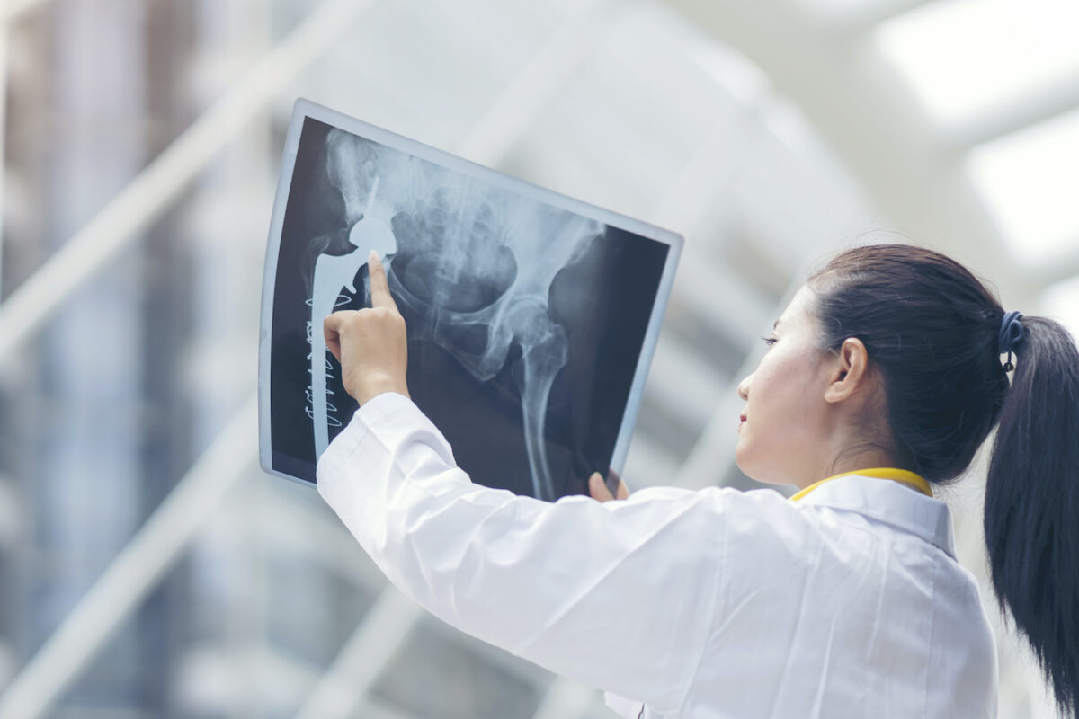 NextImg:How to Boost Your Lymphatic System, Improve Bone Healing