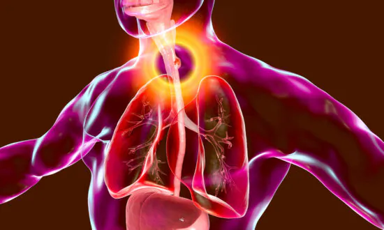 Esophageal Cancer: 1 of Least Studied Common Cancers, 5 Ways to Prevent