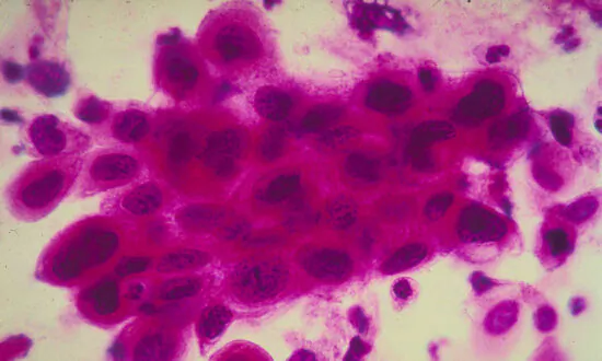 Over 14 Million Americans Living Near Facilities Releasing Cancer-Causing Gas: Report