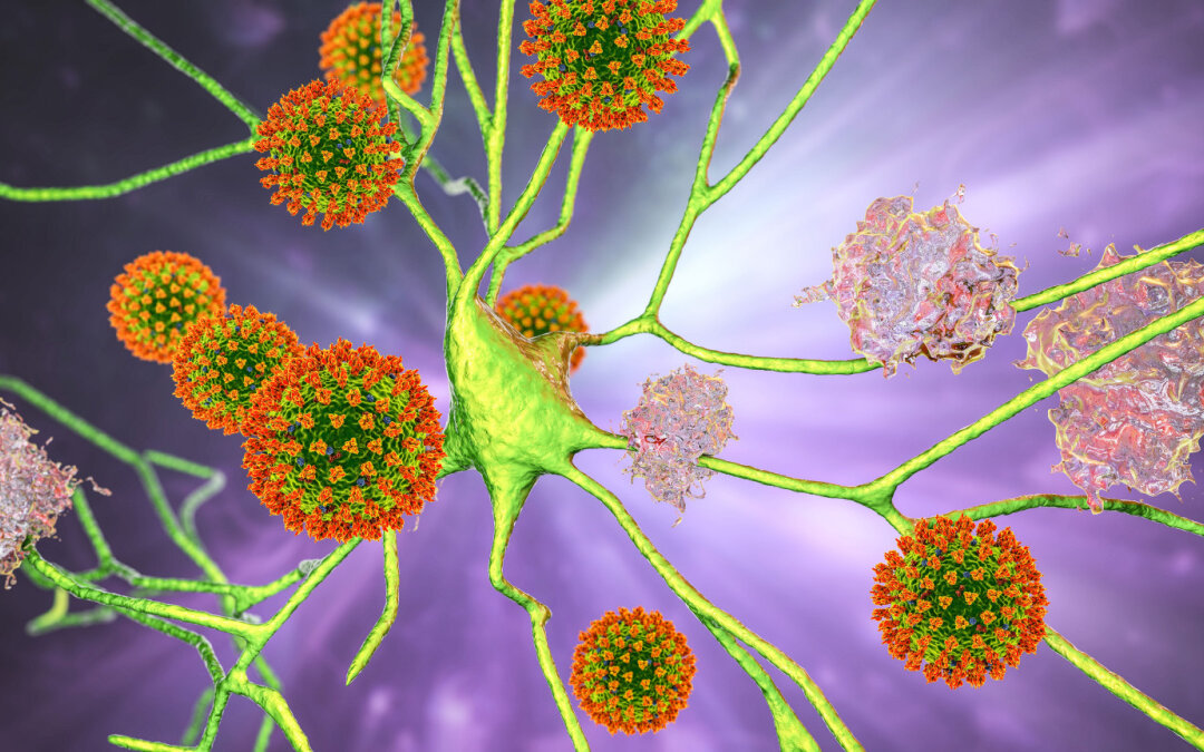 COVID-19 brings negative energy to the brain and worsens Alzheimer's disease. (Kateryna Kon/Shutterstock）