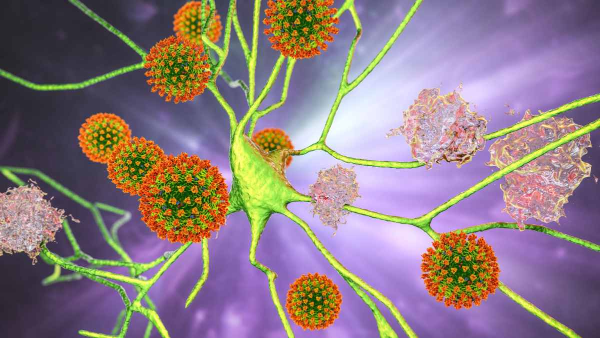 The Alzheimer's-COVID-19 Connection, 1 Practice Can Help - Vimarsana News