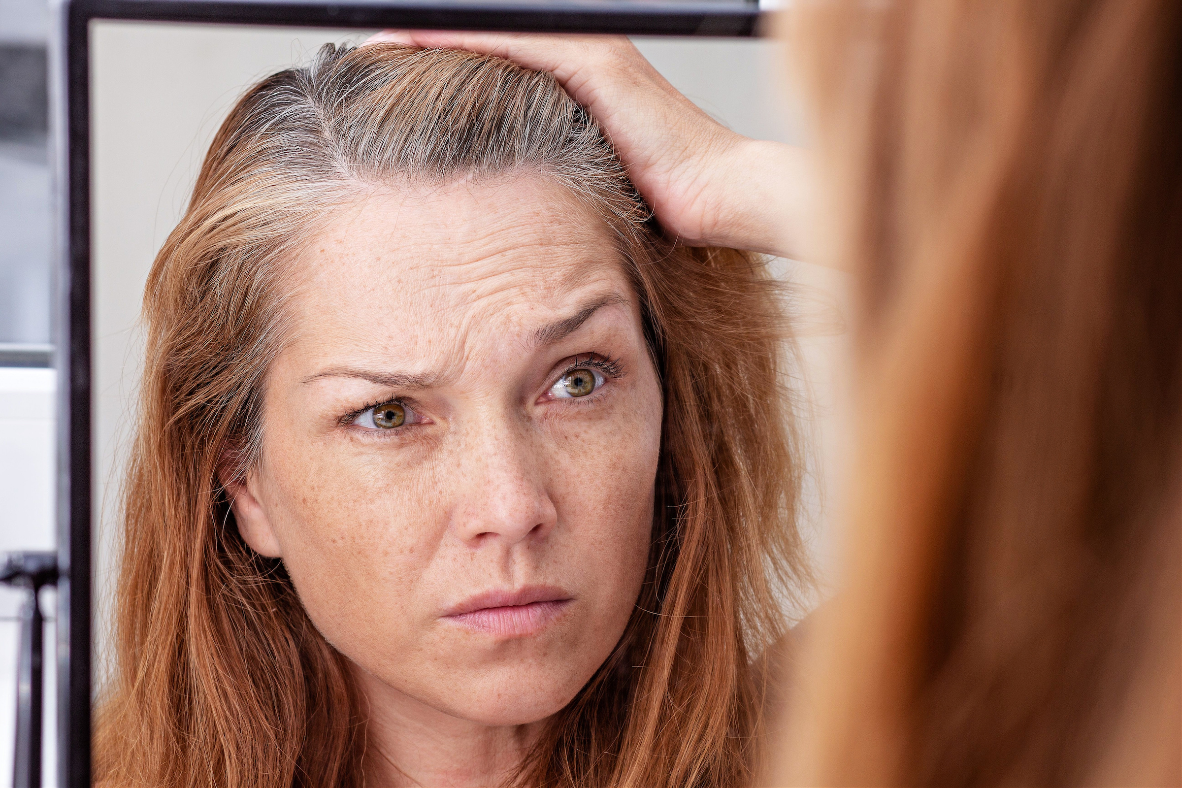 Discover How to Avoid Premature Gray Hair With Nutritional Support