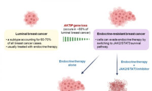 Study: Tumor Suppressor Gene Deletion Causes Resistance to Breast Cancer Treatment