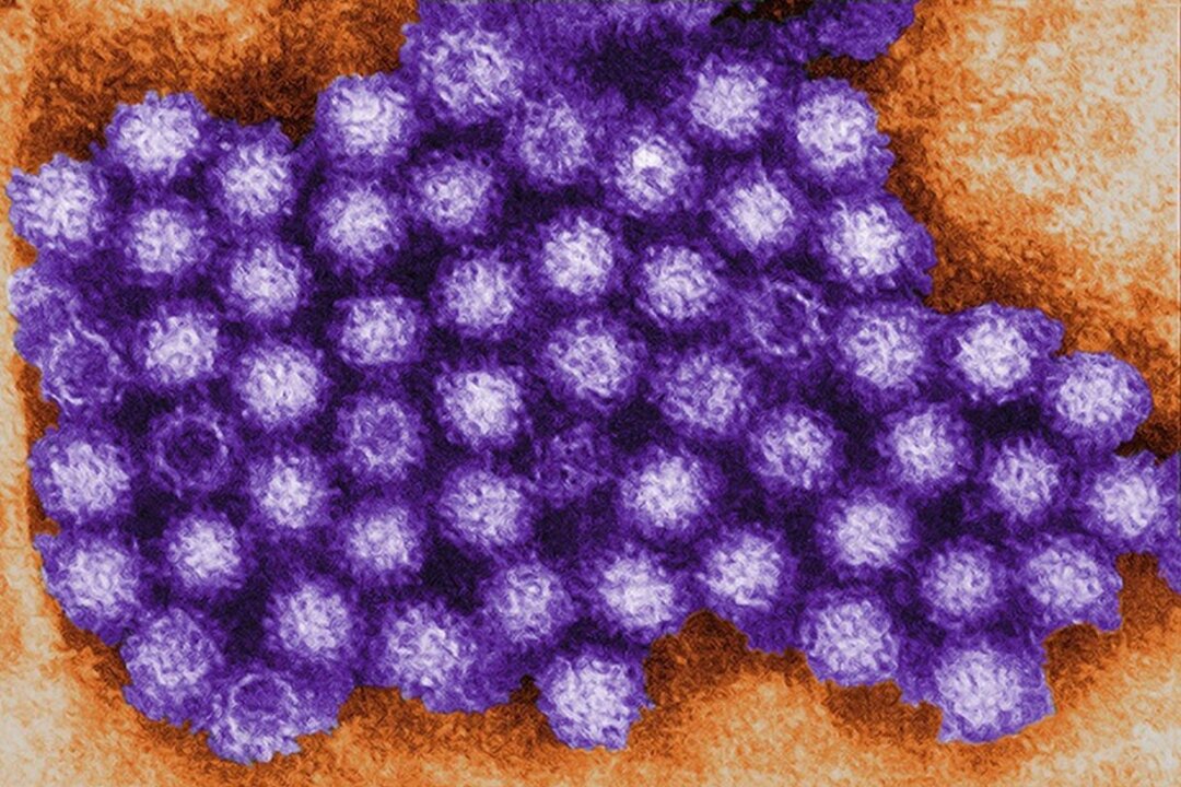 Transmission electron micrograph shows norovirus particles in an undated file photo. (Charles D. Humphrey/US Centers for Disease Control and Prevention)