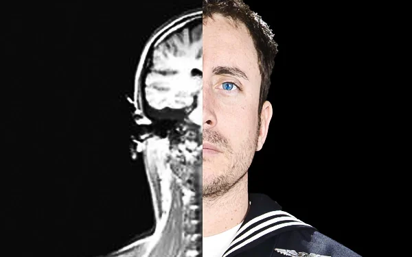 A self portrait of Jonathan David Chandler. One half of the image shows him in his military uniform and was taken while receiving treatment for TBI suffered while serving in Afghanistan. The second half is an MRI scan. (DoD photo by Petty Officer 2nd Class Jonathan David Chandler)