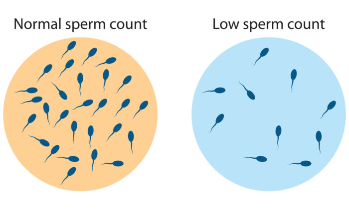 Global Sperm Counts Declining at Accelerating Rate: New Meta-Analysis