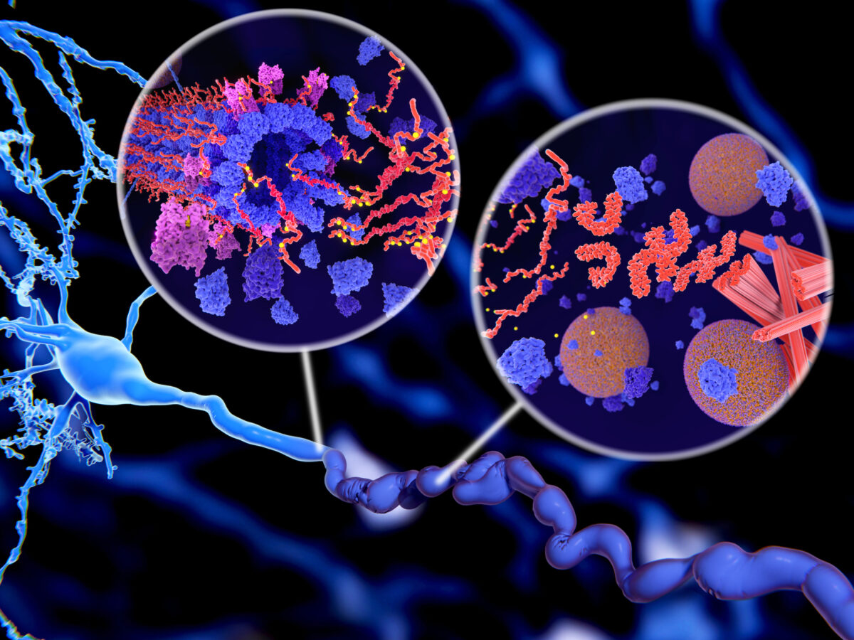 NextImg:Case Study Reveals How Cognitive Decline Can Be Reversed
